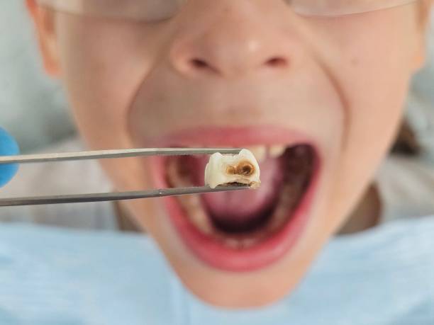 Best Emergency Pediatric Dental Care in Silverton, OH